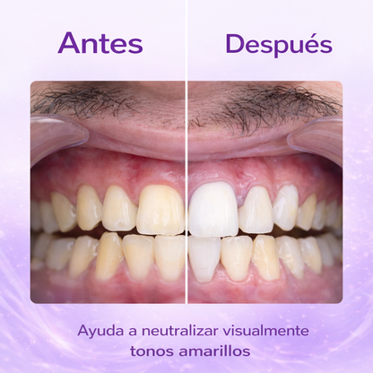 Pasta Violeta Blanqueadora de Dientes 🦷✨